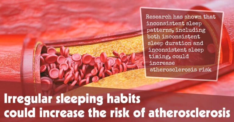 Irregular Sleep Patterns May Heighten the Risk of Atherosclerosis